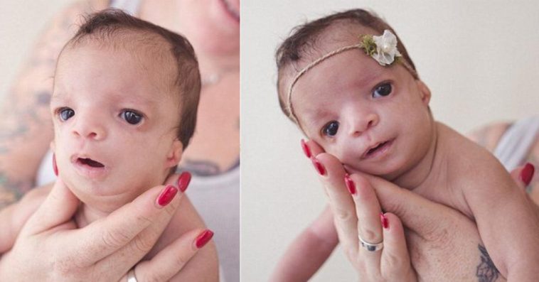  Adoptive Mother Takes One Look At The Babies Face And Runs Out Of The Nursery Crying [PHOTO]